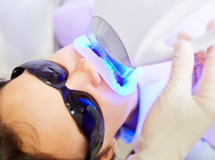 Blue Light Teeth Whitening: Is It Safe, and Does It Work?